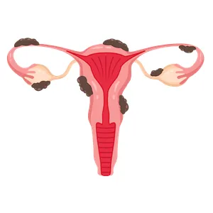 Inicio Ginecología y Obstetricia en Morelia